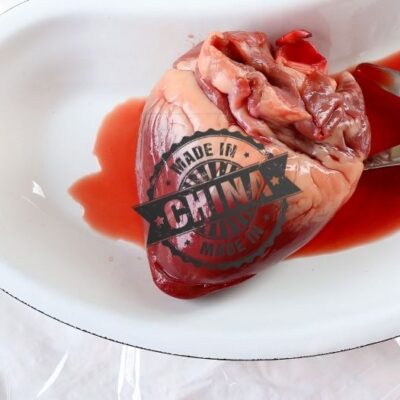 LOS TRASPLANTES DE ORGANOS AHORA SON MADE IN CHINA
